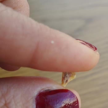 Burger King İçinden Sert Cisim Çıktı