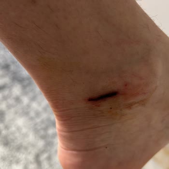 Starbucks Başıboş Köpek Var