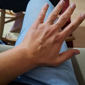 Samsung A54 Kamera Sorunu