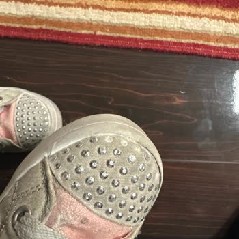 Skechers Bot En Fazla 5 Kez Giyildi Ve Her Tarafı Patlak Soyulmuş