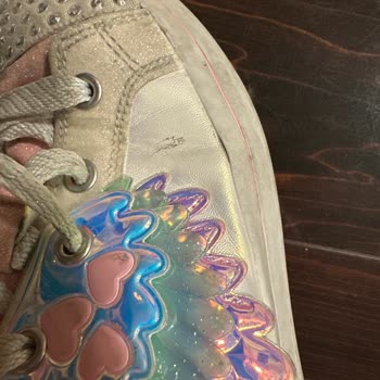 Skechers Bot En Fazla 5 Kez Giyildi Ve Her Tarafı Patlak Soyulmuş