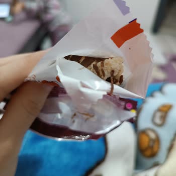 Torku Yabancı Cisim Çıktı