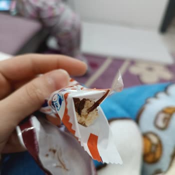 Torku Yabancı Cisim Çıktı