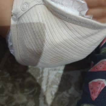 Sleepy Bezin Ortası Delik