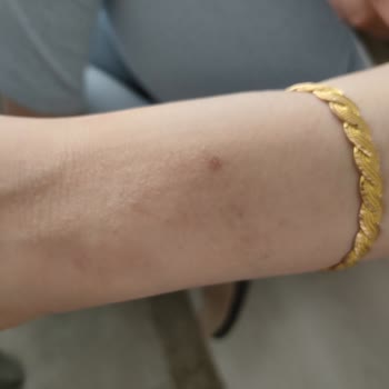 Ahlatcı Kuyumculuk Alerji Yapan Saate Çözüm Arayışı