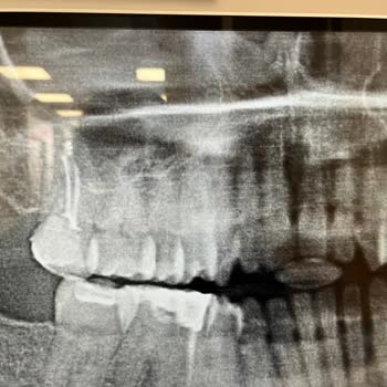 Dentaydın Diş Hastanesi Şikayeti
