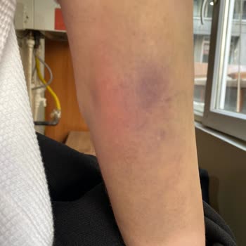 Türk Kızılay Kan Verme Sonucu Aşırı Morluk