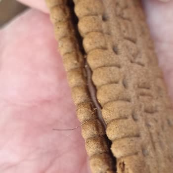 Ülker Hijyene Daha Fazla Dikkat Etmeli!