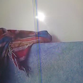 Vestel TV Çizgi Oluştu