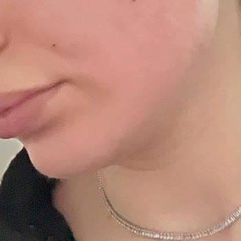 The Purest Solutions Cilt Bakım Ürününden Yaşanan Olumsuz Deneyim