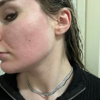 The Purest Solutions Cilt Bakım Ürününden Yaşanan Olumsuz Deneyim