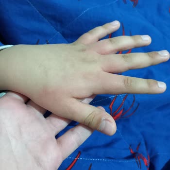 Tereson Alerjisi Uyku Uyutmuyor