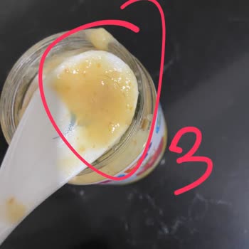 Hipp Hazır Kavanoz Mamada 3 Tane Kıl Çıktı!