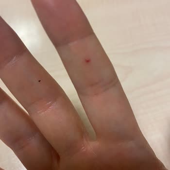 Rossmann Alterra Cam Serum Açarken Elimde Parçalandı