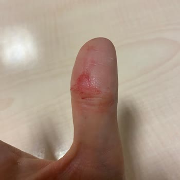 Rossmann Alterra Cam Serum Açarken Elimde Parçalandı