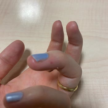 Rossmann Alterra Cam Serum Açarken Elimde Parçalandı