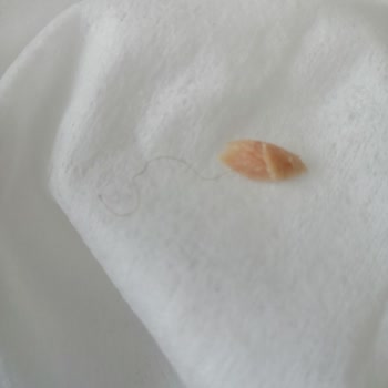 Dardanel Ton Balıktan Kıl Çıktı