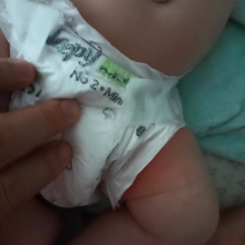 Mustela Krem Alerji Yaptı Bebeğime