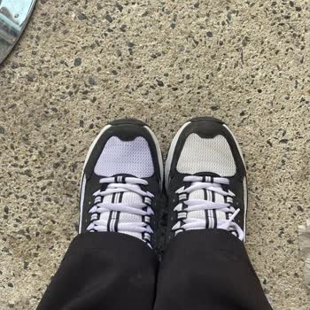Skechers Satış Sonrasında Kullanıcısının Asla Arkasında Durmayan Bir Firma.