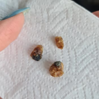 Harras Kuru Dutun İçinden Çıkan Taşlar