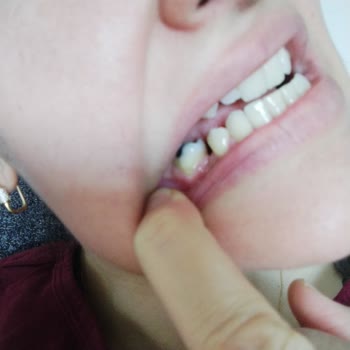 Gölcük Ağız Ve Diş Sağlığı Merkezi Gölcük Agiz Dis Hastenesi Dr. R. P. Hasta İle Konuşması Bilmeyen Biri