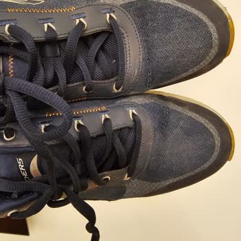 Skechers Aldım Fakat Marka Ürünün Arkasında Durmadı