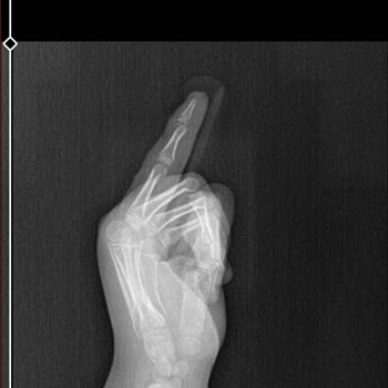 Metin Sabancı Baltalimanı Kemik Hastalıkları Eğitim ve Araştırma Hastanesi İlgisiz Acil Servis