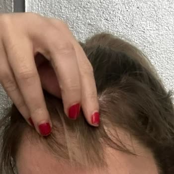 San Kuaför Maltepe Saçımı Yaktı