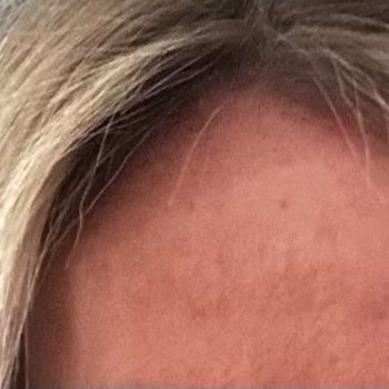 San Kuaför Maltepe Saçımı Yaktı