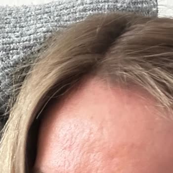 San Kuaför Maltepe Saçımı Yaktı