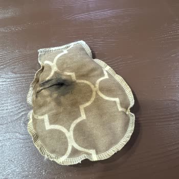 ebebek Gaz Çıkarıcı Kemer Yandı.