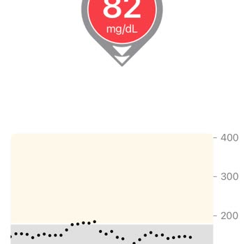 Dexcom Kan Şekeri Hatası