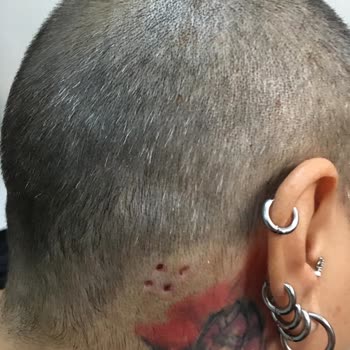 Novar Poliklinik İzmir Alsancak Mağdur Etti! Sonuçsuz İşlem Yüklü Paralar