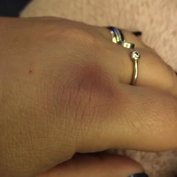 Novar Poliklinik İzmir Alsancak Mağdur Etti! Sonuçsuz İşlem Yüklü Paralar