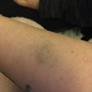 Novar Poliklinik İzmir Alsancak Mağdur Etti! Sonuçsuz İşlem Yüklü Paralar