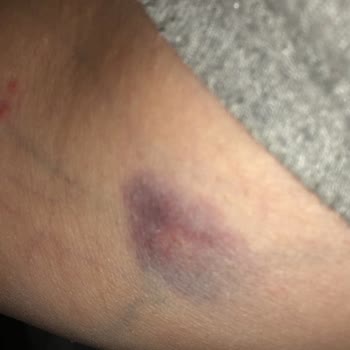 Novar Poliklinik İzmir Alsancak Mağdur Etti! Sonuçsuz İşlem Yüklü Paralar