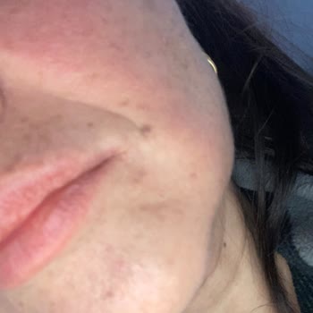 Procsin Yüz Serumları Şikayet