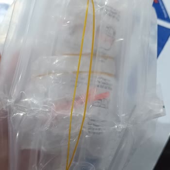 Xiaomi Ouno Servisi Faturamı Ve Garanti Belgesini Kaybettiler