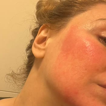 Naos Bioderma Serum Yakın Etkisi Acil İade Talebi