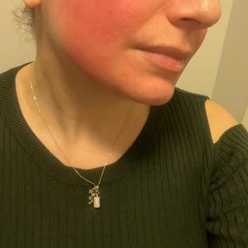 Naos Bioderma Serum Yakın Etkisi Acil İade Talebi