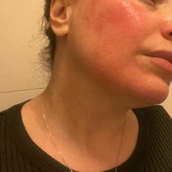 Naos Bioderma Serum Yakın Etkisi Acil İade Talebi