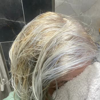 Garnier 10.1 Aschblond Haarfarbe führt zu unvorhergesehene Blaufärbung und Hautreizung