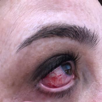 Zara Buyaka AVM Yüzünden Kör Oluyordum