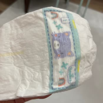 Prima Premium Care Bezi Bebeğimin Cildine Zarar Verdi