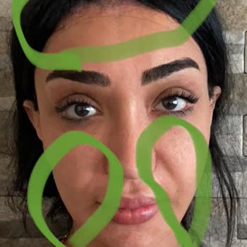 Prof. Dr. Murat Türegün Şikayetçiyim Ve Kazanacağım