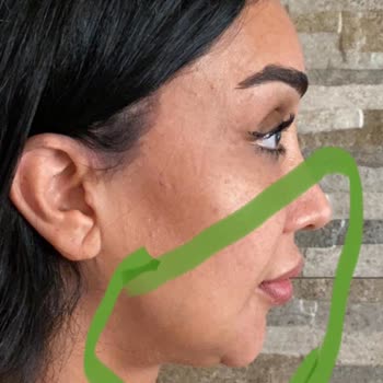 Prof. Dr. Murat Türegün Şikayetçiyim Ve Kazanacağım