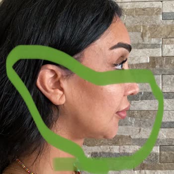 Prof. Dr. Murat Türegün Şikayetçiyim Ve Kazanacağım