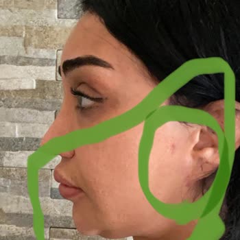 Prof. Dr. Murat Türegün Şikayetçiyim Ve Kazanacağım