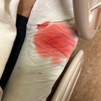 Denizli Özel Sağlık Hastanesi Hastanenizin Çalışan Personellerinden Şikayetçiyim