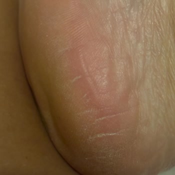 Asics Gel Kayano 30 Hatalı Üretim.